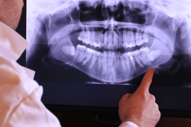 Best Emergency Cosmetic Dentistry in Crawfordsville, IN